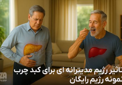 تاثیر رژیم مدیترانه ای برای کبد چرب