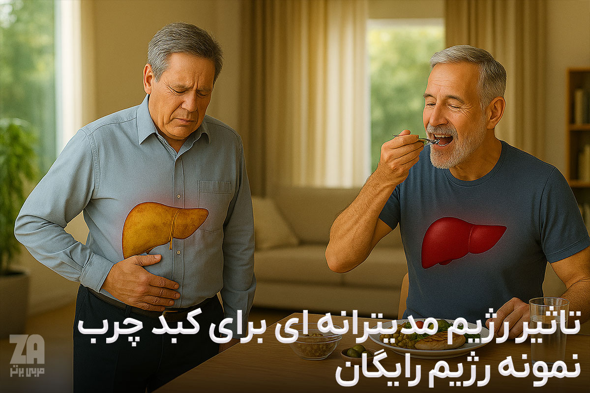 تاثیر رژیم مدیترانه ای برای کبد چرب