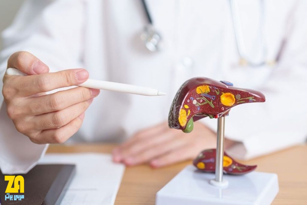 زمان مراجعه به متخصص برای دریافت رژیم غذایی کبد چرب
