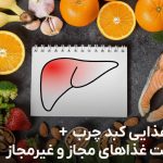 رژیم کبد چرب