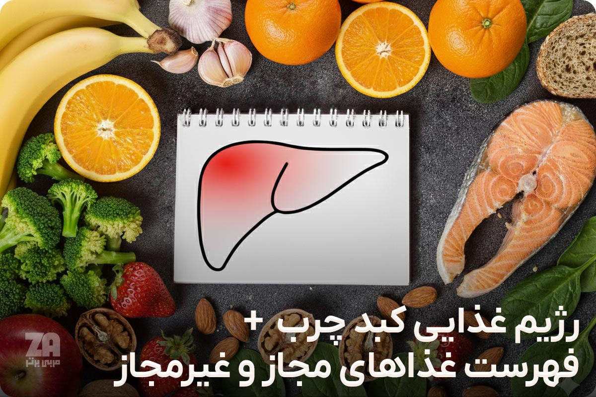 رژیم کبد چرب