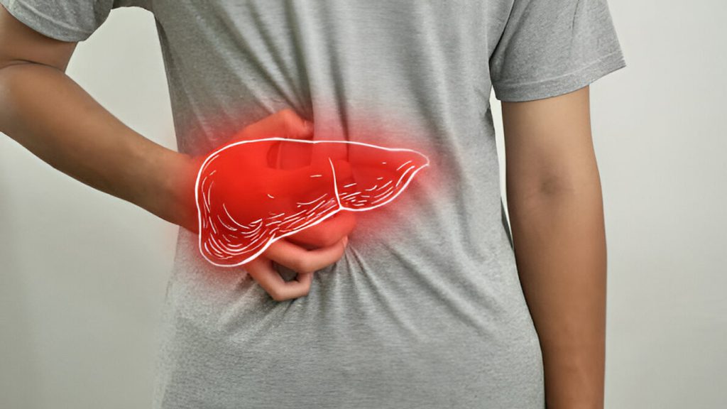 رژیم غذایی برای کبد چرب