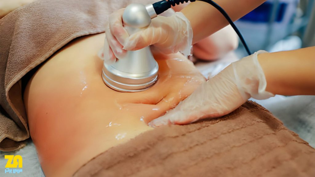 روش های پزشکی برای رژیم لاغری سریع شکم و پهلو در سه روز